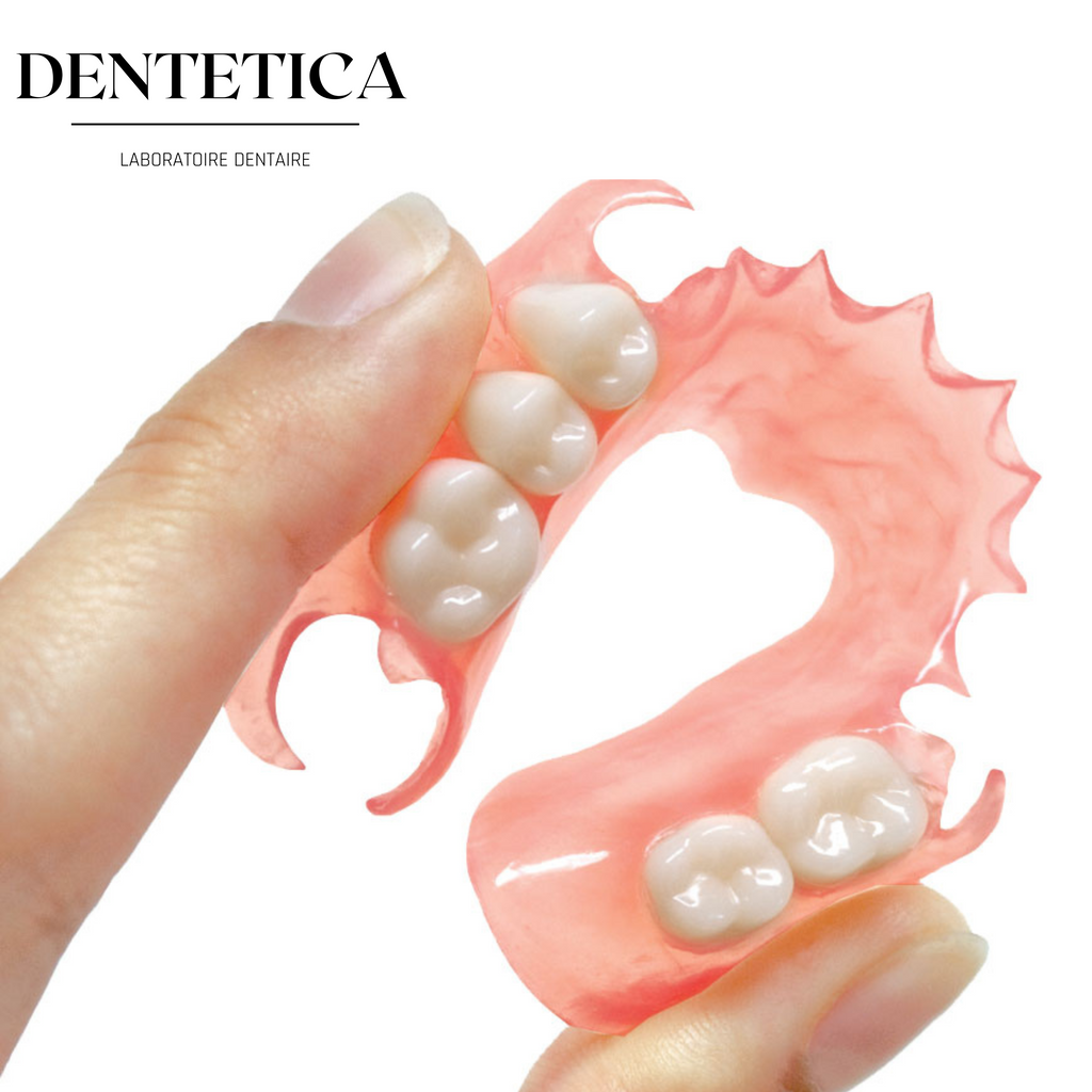 Prothèse dentaire amovible prix & tarif - Traitement dentaire - Dentego