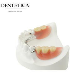 100x Fausse Temporaires Provisoire Prothèse Dentaire Veneer Antérieure Dents
